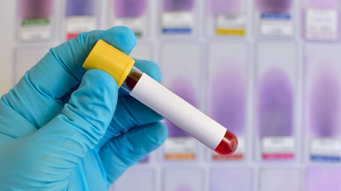 Health officials promote testing and education during STI Awareness Week