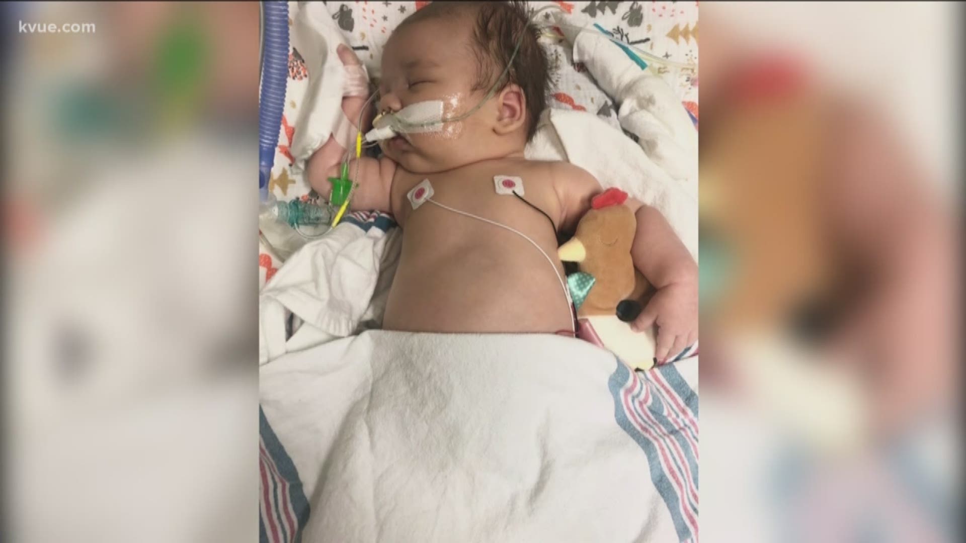 The baby is in critical condition on a ventilator and his family is trying to figure out why.