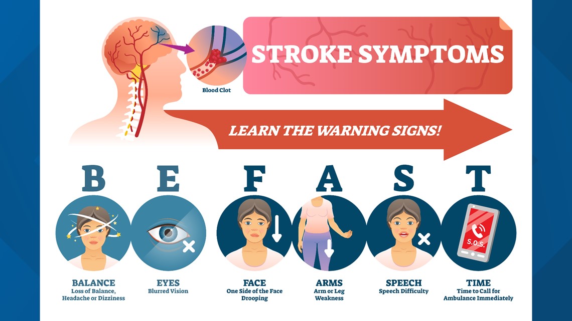Prisma Health doctor wants you to know the signs of a stroke | wltx.com