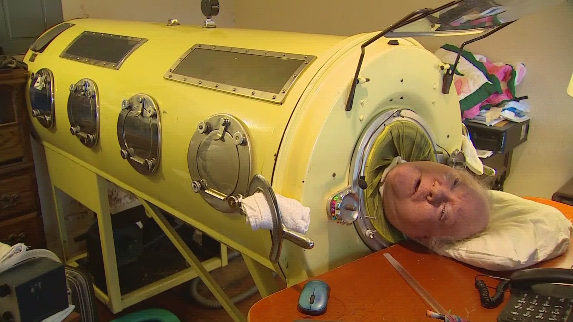 Man who lived in iron lung, Paul Alexander, dies at 78