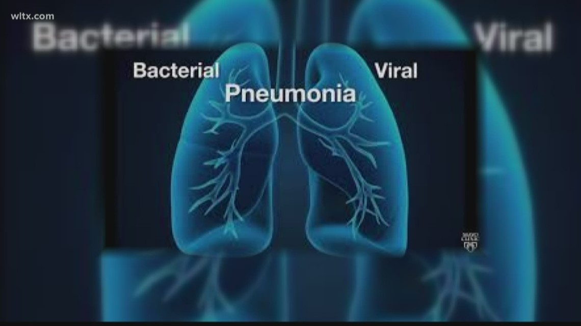 What Is The Connection Between Influenza And Pneumonia? | Wltx.com