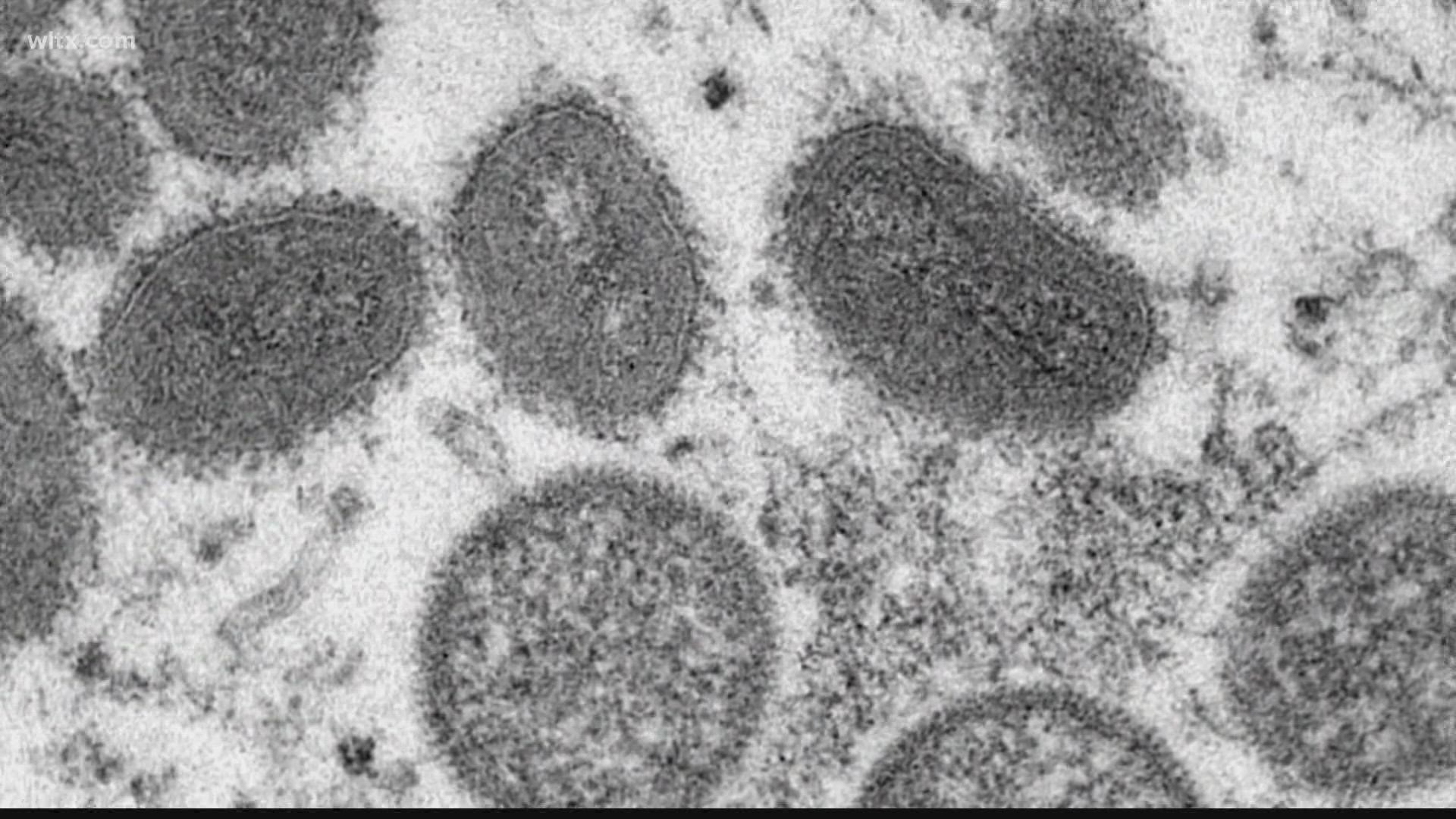 DHEC has now confirmed two cases of monkey pox in South Carolina.
