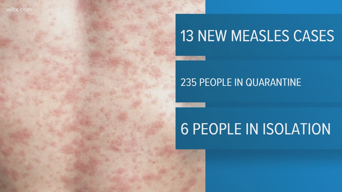 Measles outbreak in South Carolina hits 933, undetected spread in Sumter, Lancaster suspected