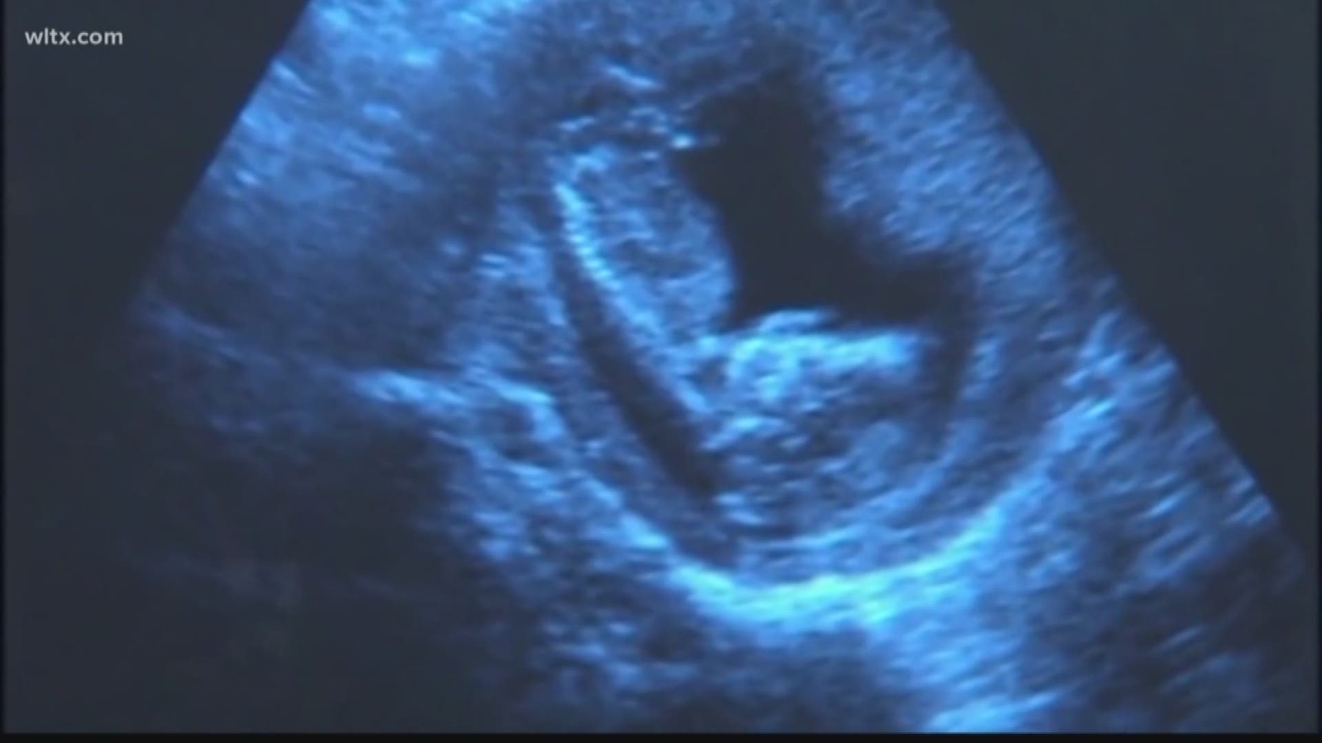 florida fetal heartbeat bill