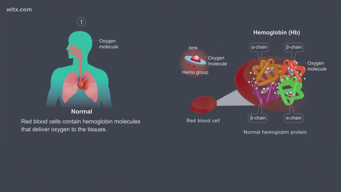 carbon dioxide poisoning after surgery