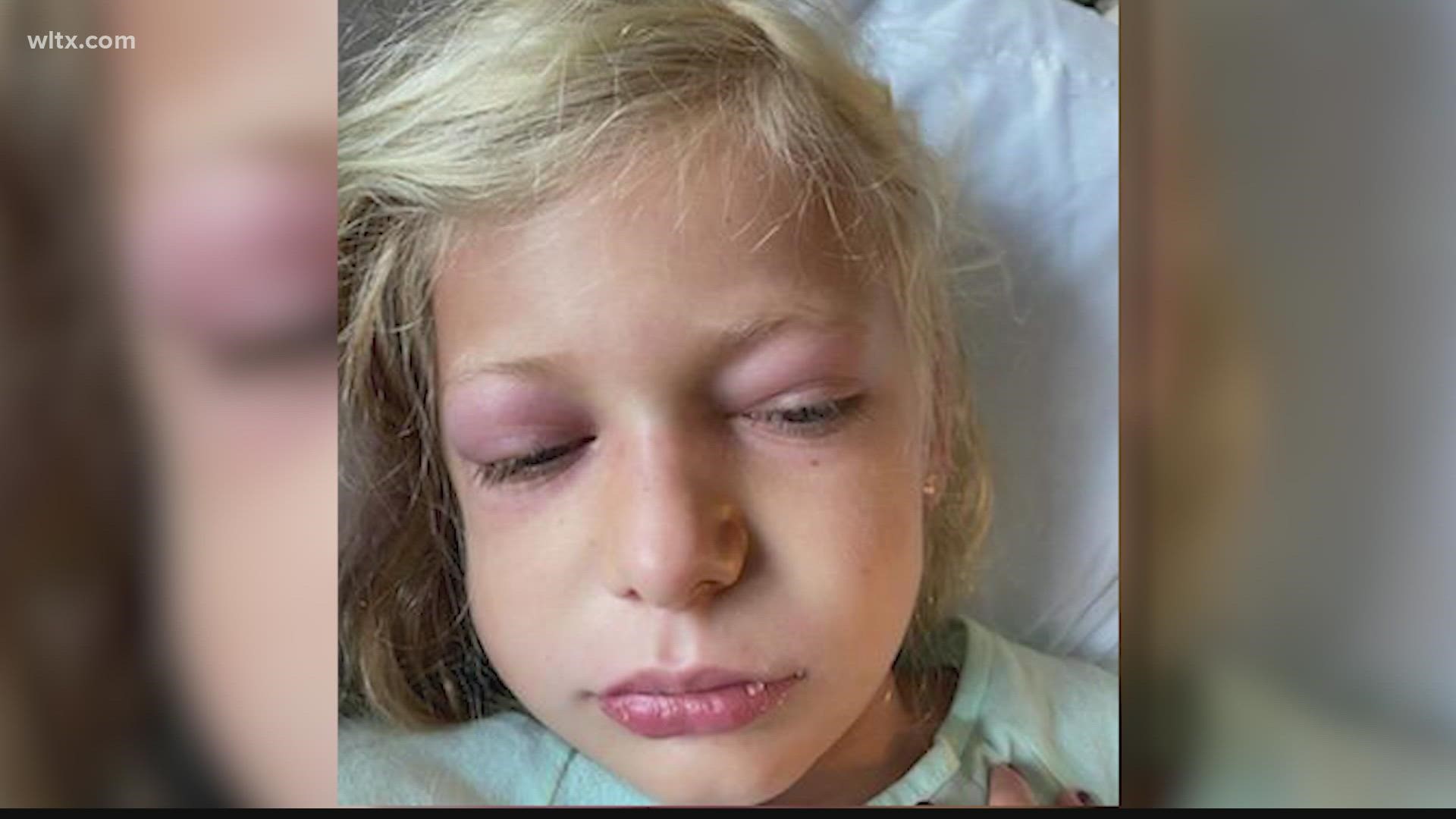 A ten-year-old South Carolina girl has recovered after her parents say she had MIS-C, which doctors say children can get after having COVID-19.