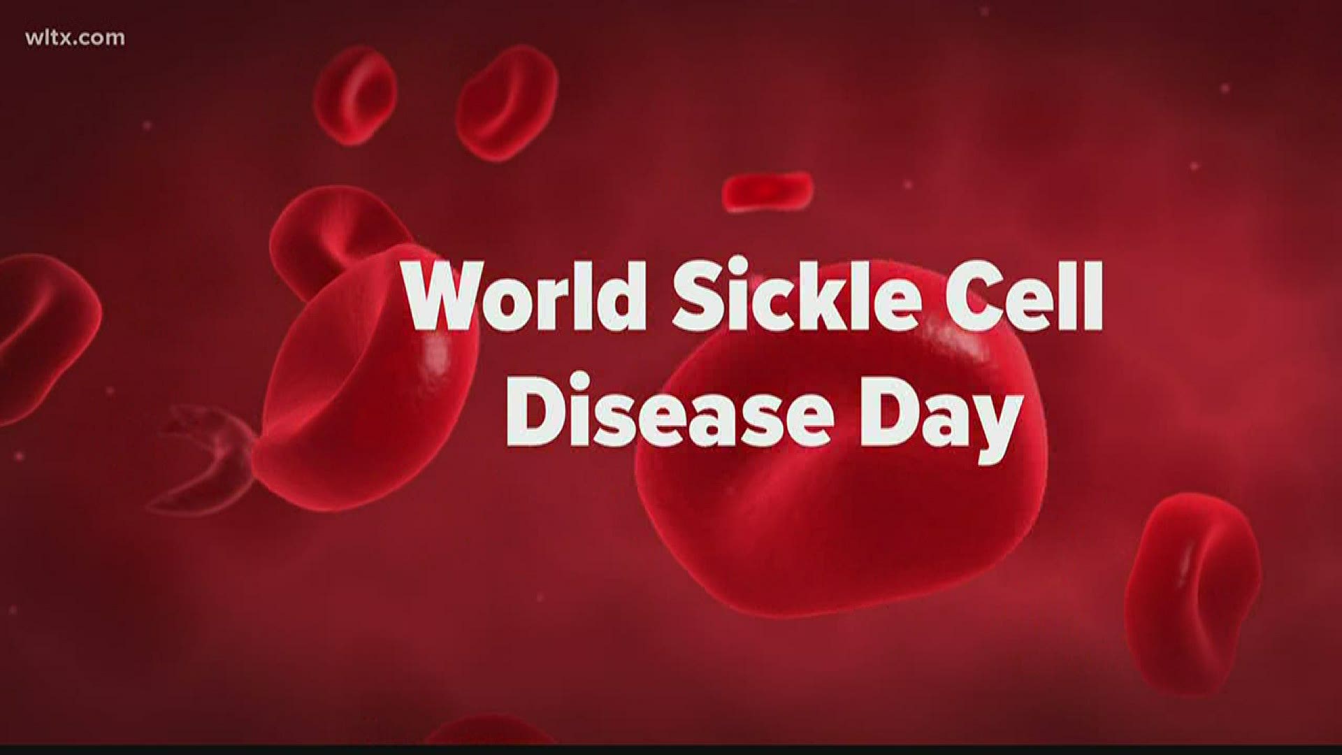The disease is a blood disorder of red blood cells. The cells become sickle or crescent shaped and have a hard time passing through small blood vessels.