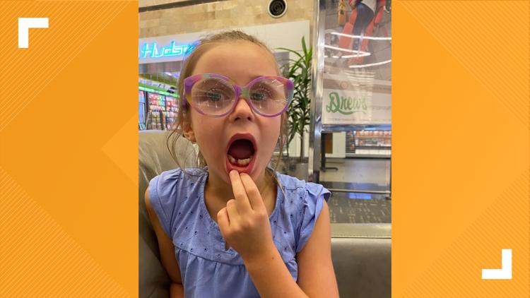 Lexington girl loses her tooth on an airplane ... and then this happens