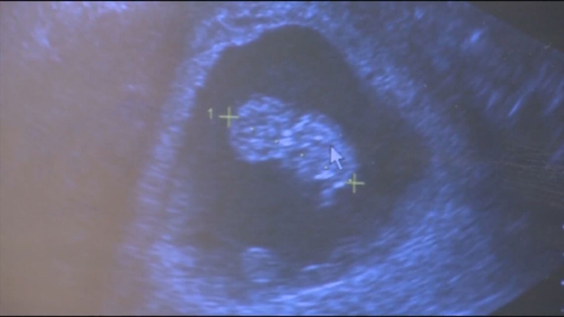 Lawmakers hold heated hearing on total abortion ban in South Carolina