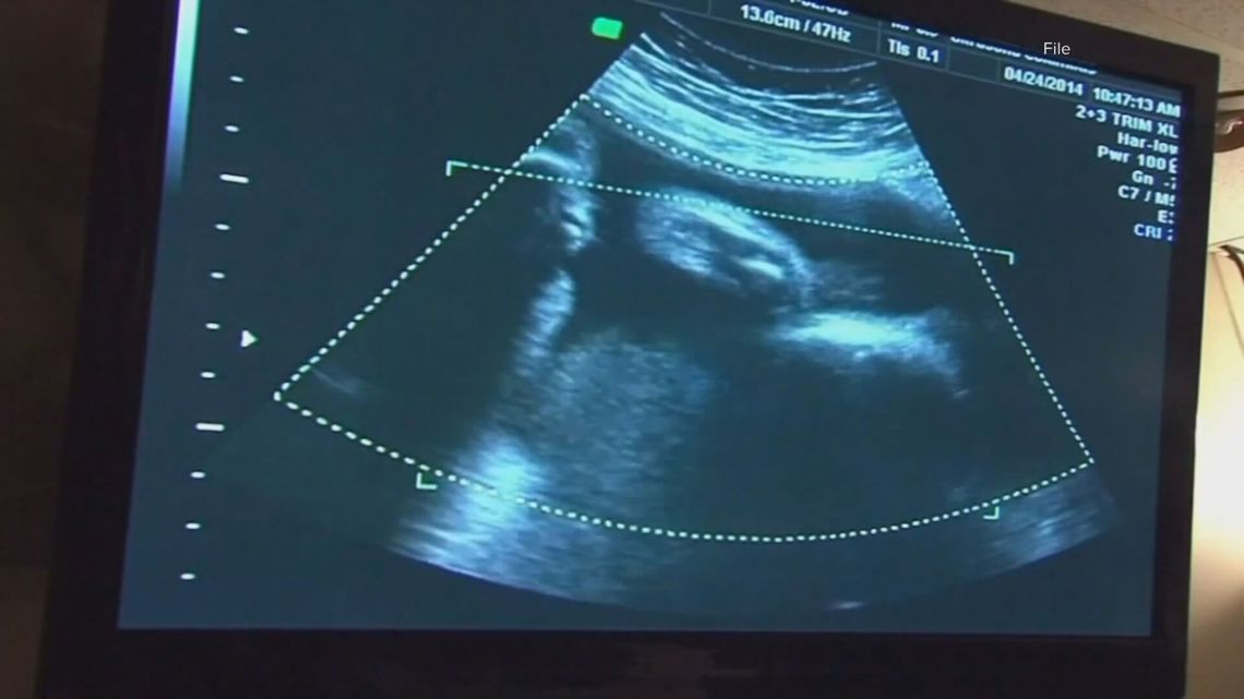 South Carolina Supreme Court weighs 'fetal heartbeat' at six weeks in abortion law